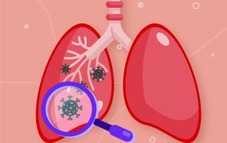 penanggulangan tbc kota semarang